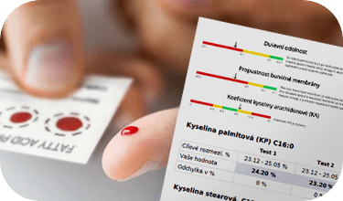 bonus vysetreni omega 3 zdarma - MedFit clinic